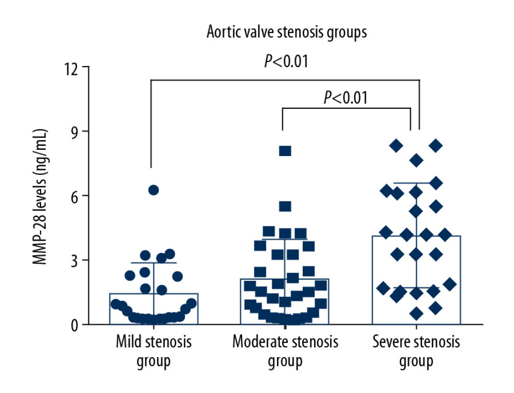 Plasma MMP-28 levels in groups with different severity of calcific aortic valve stenosis. The levels of MMP-28 in mild, moderate, and severe stenosis groups were 1.33±1.47, 2.04±1.85, and 4.02±2.44 ng/mL, respectively. The level of MMP-28 was significantly higher in the severe stenosis group than in the other groups (P<0.05).