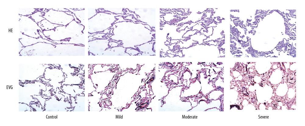 Comparison of alveolar septa thickness and fiber morphology (H&E, ×100 magnification; EVG, ×100 magnification).