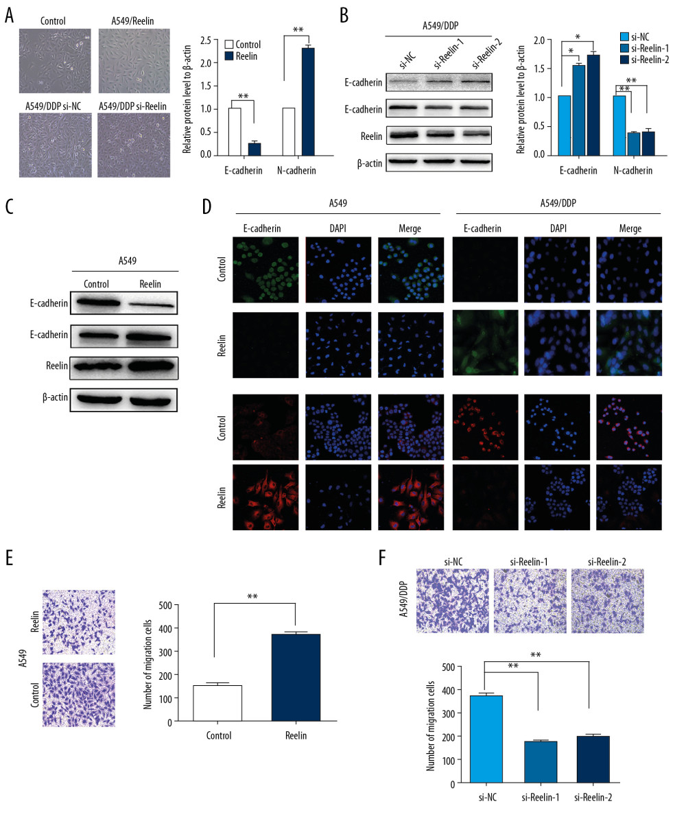 Reelin promotes EMT in NSCLC cells. (A) Cell morphological observations after Reelin overexpression (A549-NC versus A549/Reelin) in A549 cells and Reelin knockdown in A549/DDP cells (A549/DDP si-NC versus A549/DDP si-Reelin). (B–D) E-cadherin and N-cadherin expressions were evaluated by western blotting and immunofluorescence in A549 cells transfected with the Reelin expression vector and A549/DDP cells transfected with Reelin si-RNA. (E, F) Cell migration was measured by Transwell migration assays. * P<0.05, ** P<0.01.