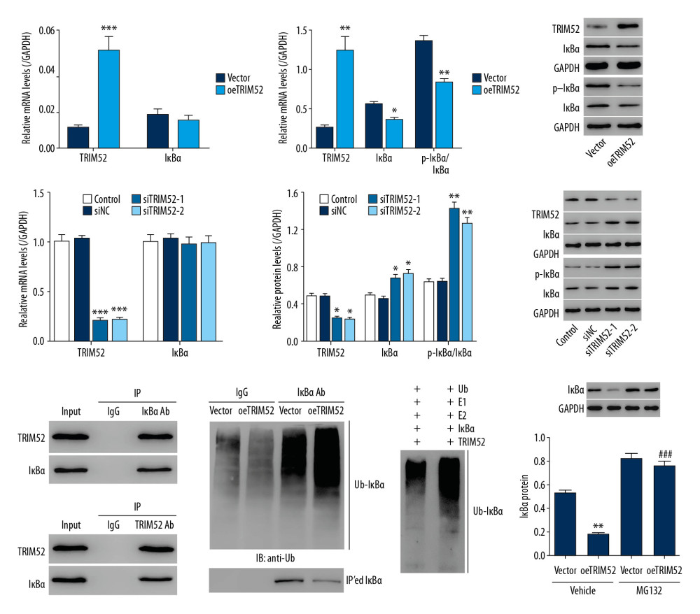 Tripartite motif containing 52 (TRIM52) activated the NF-κB signaling pathway through promotion of IκBα protein ubiquitination. TRIM52 gene overexpression lentivirus transfected rat primary microglial cells: (A) The mRNA expression of TRIM52 and IκBα was detected by Q-PCR. (B) The protein levels of TRIM52, IκBα, and p-IκBα were detected by western blot. TRIM52 gene interference lentivirus transfected rat primary microglial cells: (C) The mRNA expression of TRIM52 and IκBα was detected by Q-PCR. (D) The protein levels of TRIM52, IκBα, and p-IκBα were detected by western blot. (E) Co-IP detected TRIM52 and IκBα interaction in rat primary microglia. (F) Overexpression of TRIM52 gene in rat primary microglia. Western blot was used to detect IκBα ubiquitination. (G) Co-IP detected TRIM52 and IκBα interaction by E3 ligase activity. (H) TRIM52 gene overexpression in rat primary microglial cells was treated with 10 μmol/L MG132 (proteasome inhibitor). Western blot was used to detect IκBα protein expression. * P<0.05, ** P<0.01, *** P<0.001 vs. Vector, siNC or Vehicle+Vector; ### P<0.001 vs. Vehicle+oeTRIM52.