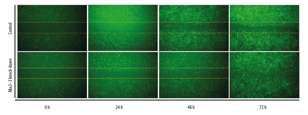 Knockdown of Nkx2–5 increase the migration ability of H9c2 cells. The cell scratch test was used to detect the effect of Nkx2–5 on the migration ability of H9c2 cells (0–72 h). Cells were seeded in the culture-insert, which was removed after 24 h, and cells were then continuously observed for 72 h.