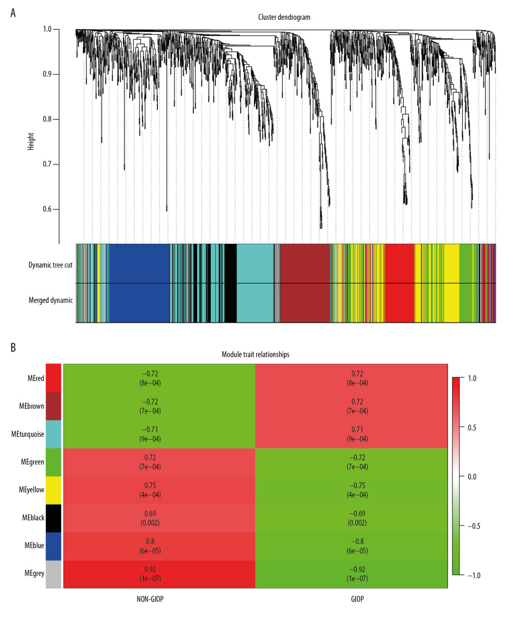 Hub module selection. (A) Dendrogram of all DEGs clustered according to a dissimilarity measure (1-TOM). (B) Heatmap of the relationships of module with the disease traits. In the module, the greater mean gene relevance stands for the greater relationship of this module with the traits of interest. The horizontal and vertical axes stand for clinical factors and modules, respectively. The color gradient from red to green represents the shift from positive to negative correlation. The numbers in grids represent correlation coefficients. Values in parenthesis are the P-values for the association test. The red, brown, and turquoise gene modules are positively related to GIOP status, values in the figure indicate the correlation coefficient between modules and clinical traits. TOM – topological overlap matrix; DEGs – differentially expressed genes; Me – module; GIOP – glucocorticoid-induced osteoporosis.