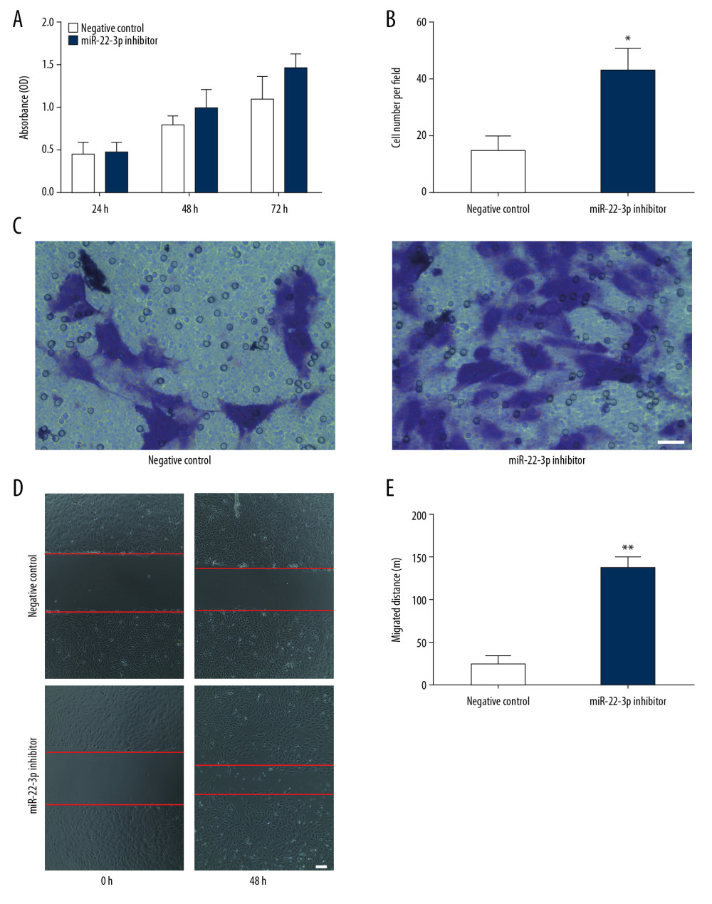 Effect of miR-22-3p on the biological function of endothelial progenitor cells (EPCs). (A) Proliferation assay showing knockdown of miR-22-3p promoted cell proliferation. (B) Statistical analysis of transwell assay revealed that inhibition of miR-22-3p increased migration of EPCs. (C) Representative microscopic images of cells that invaded through the transwell. (D) EPCs transfected with miR-22-3p inhibitor showed more migrated distance. (E) Statistical results from wound-healing assay. * P<0.05; ** P<0.01.