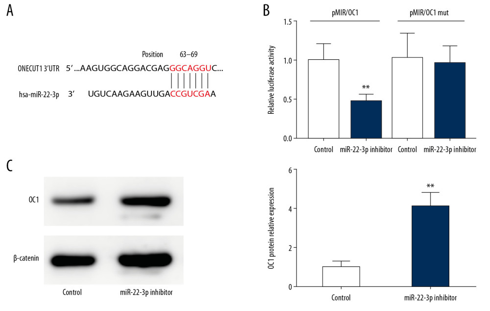 Onecut 1 (OC1) is negatively regulated by miR-22-3p. (A) Bioinformatic analysis predicted the 3′-untranslated region (UTR) of OC1 with the potential binding sites of miR-22-3p. (B) Luciferase report assay showed the activity in different groups. (C) Western blot analysis revealed the protein expression of OC1. ** P<0.01.