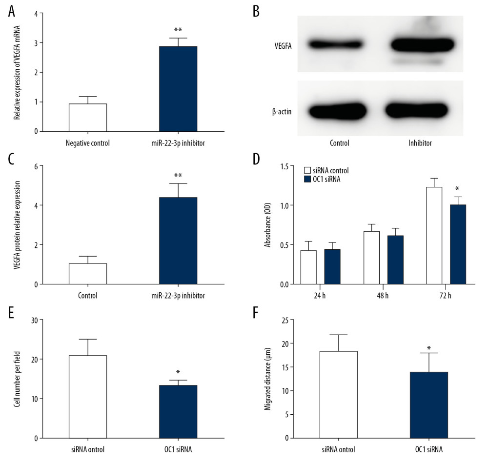MiR-22-3p negatively regulates the expression of vascular endothelial growth factor A (VEGFA). (A) VEGFA messenger ribonucleic acid (mRNA) expression detected by quantitative real-time polymerase chain reaction (qRT-PCR) in different groups. (B) VEGFA protein expression analyzed by Western blot in different groups. (C) Quantitative analysis of VEGFA protein level in endothelial progenitor cells (EPCs) transfected with different duplexes. (D) Cell-Counting Kit 8 (CCK-8) assay showed the proliferative ability of EPCs in different groups. (E) Transwell assay revealed migration of EPCs transfected with either small interfering (si)RNA control or OC1 siRNA. (F) Wound-healing assay detected the migration ability of EPCs in different groups. * P<0.05; ** P<0.01.