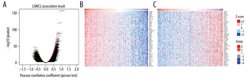 LAMC2 and its significantly correlated genes in HNSC (LinkedOmics). (A) The genes positively and negatively correlated with LAMC2 in HNSC. (B) Heatmaps of the top 50 genes positively correlated with LAMC2 in HNSC. (C) Heatmaps of the top 50 genes negatively correlated with LAMC2 in HNSC. HNSC – head and neck squamous cell carcinoma.