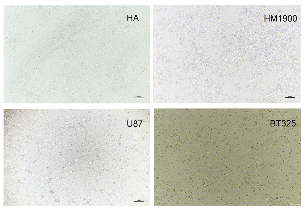 Cellular morphology of HA and HM-1900, U-87, and BT-325 cells in vitro (magnification 200×).