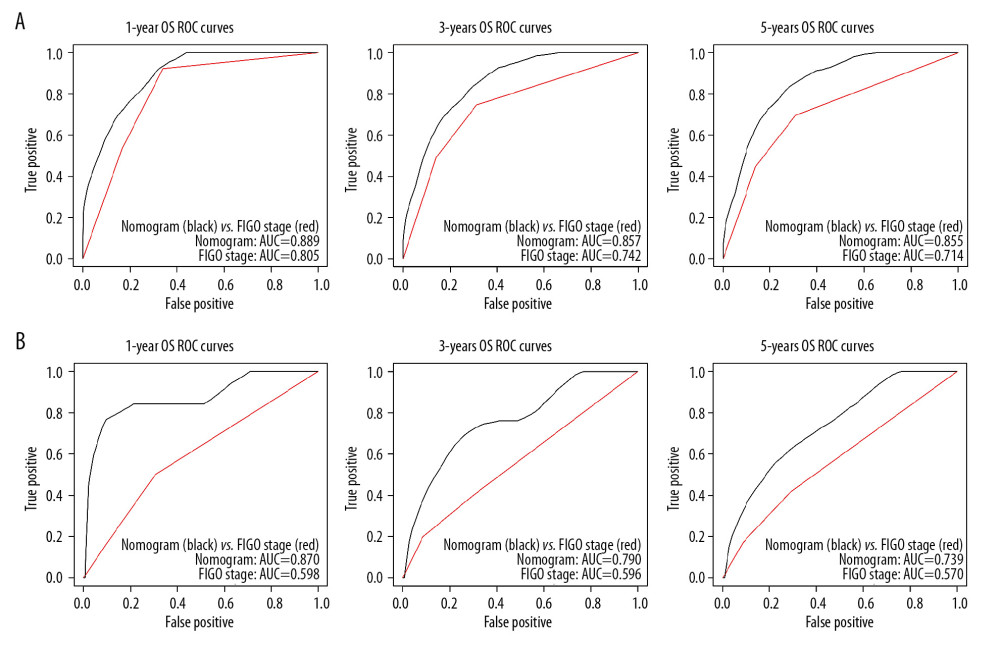 ROC curves of the nomogram and FIGO stage for 1-, 3-, and 5-year overall survival (OS) in (A) training set and (B) internal validation set. ROC – receiver operating characteristic; AUC – area under the curve.