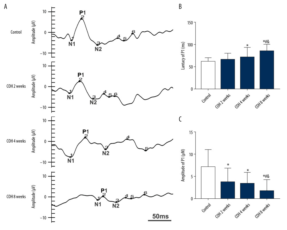 Changes of latency and amplitude of P1 induced by chronic ocular hypertension (COH) in Flash Visual evoked potentials (F-VEP) test. (A) F-VEP detection waveforms of rats at 0, 2, 4, and 8 weeks of COH. (B) The latency of the P1 increases along in accordance with the prolongation of COH. The latencies of 4 and 8 weeks after COH were significantly longer than that of the control group (n=28; * P<0.05 versus the control group, # P<0.05 versus the COH 2 weeks group, & P<0.05 versus the COH 4 weeks group); (C) The amplitude of P1 decreased along with the prolongation of COH. The amplitudes at 2, 4, and 8 weeks after COH were significantly lower than that of the control group (n=28; * P<0.05 versus the control group, # P<0.05 versus the COH 2 weeks group, & P<0.05 versus the COH 4 weeks group).