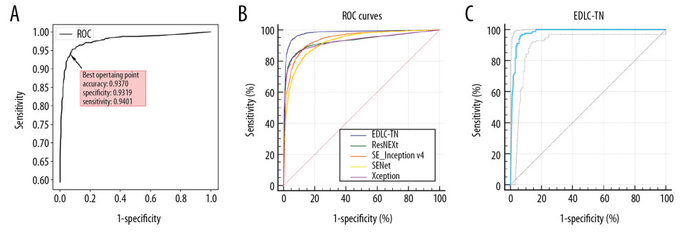 Performance of the EDLC-TN in identification of thyroid cancer in different datasets. (A) Performance of the EDLC-TN on the training dataset. The accuracy, sensitivity and specificity were 93.70%, 93.19%, and 94.01%, respectively. (B) Diagnostic performance of the EDLC-TN and four other state-of-the-art machine learning algorithms. The EDLC-TN demonstrated the highest value for AUC (0.941, 95% CI: 0.935–0.946), sensitivity (93.77%), specificity (94.44%), and accuracy (98.51%). (C) The performance of EDLC-TN on the external validation dataset. The EDLC-TN achieved an accuracy of 95.76%, with a sensitivity of 95.88%, a specificity of 93.75% and an AUC of 0.979 (95% CI: 0.958–0.992).