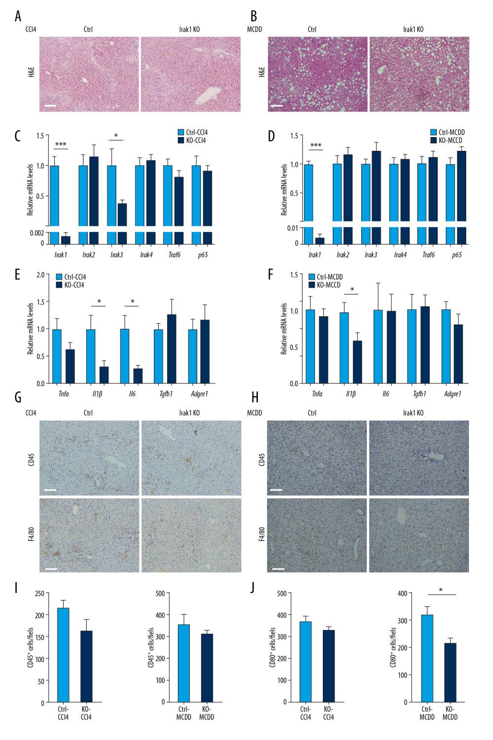Effects of Irak1 KO on key pro-inflammatory factors and inflammatory cell infiltration in the livers in mouse models of NASH. (A, B) Representative H&E-stained liver sections of Irak1 KO and control mice following (A) treatment with CCl4 for 8 weeks or (B) MCDD feeding for 6 weeks. Scale bars, 100 μm. (C, D) Hepatic Irak1, Irak2, Irak3, Irak4, Traf6, and p65 mRNA levels in Irak1 KO and control mice following (C) treatment with CCl4 for 8 weeks (n=5) or (D) MCDD feeding for 6 weeks (n=5–6). (E, F) Hepatic Tnfα, Il1β, Il6, Tgfb1, and Adgre1 mRNA levels in Irak1 KO and control mice following (E) treatment with CCl4 for 8 weeks (n=5) or (F) MCDD feeding for 6 weeks (n=5–6). (G, H) Representative CD45 (upper part) and F4/80 (bottom part) positively-stained liver sections of Irak1 KO and control mice following (G) treatment with CCl4 for 8 weeks or (H) MCDD feeding for 6 weeks. Scale bars, 100 μm. (I, J) Numbers of (I) CD45-positive and (J) F4/80-positive cells per field from Irak1 KO and control mice following CCl4 treatment for 8 weeks (n=3–4, 5 fields per mouse) or MCDD feeding for 6 weeks (n=3–4, 5 fields per mouse). Data represent mean±SEM. * p<0.05, ** p<0.01, *** p<0.001, by t test.