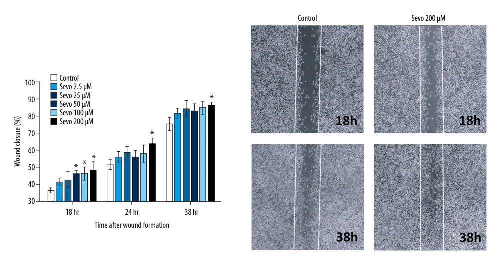 0Cell migration by wound healing assay. The variables are presented as mean±SEM (n=8 per each group). Sevo – sevoflurane. * P<0.05 compared with the control.