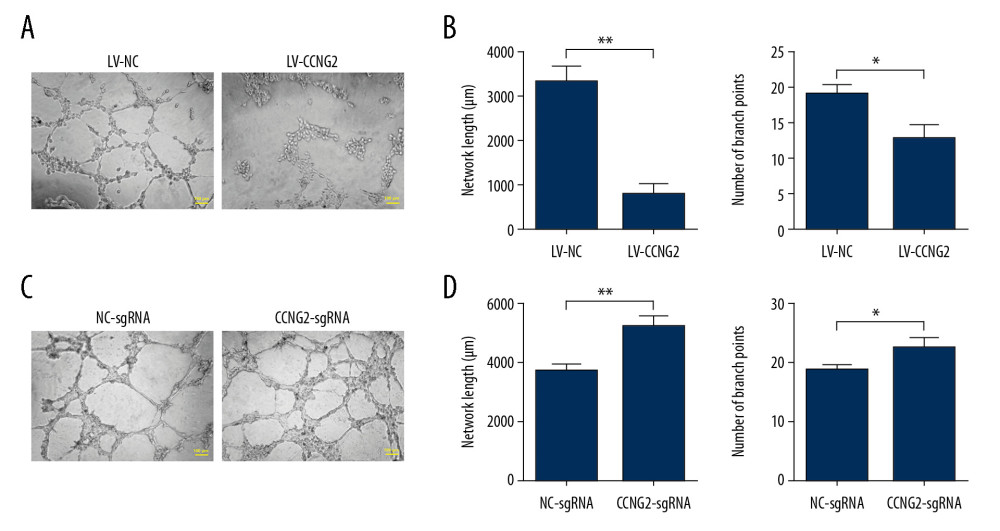 CCNG2 impairs the network formation of HTR8/SVneo cells. (A) Network formation assay to determine the angiogenic capacity of HTR8/SVneo cells overexpressing CCNG2. Original magnification×100. (B, C) Statistical analyses of total network length (B) and number of branch points (C) during network formation in cells overexpressing CCNG2, as determined using ImageJ software. (D) Network formation assay to determine the angiogenic capacity of HTR8/SVneo cells with CCNG2 silencing. Original magnification×100. (E, F) Statistical analyses of total network length (E) and number of branch points (F) during network formation in cells with CCNG2 knockdown, as determined using ImageJ software. Each experiment was independently performed 3 times. * P<0.05 and ** P<0.01 vs. control.
