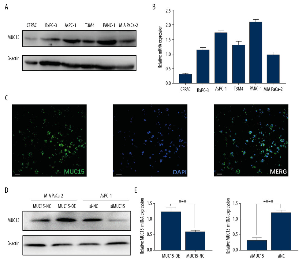 The expression of MUC15 in PC cell lines and transient transductions of MUC15 overexpression and knockdown were established. (A) MUC15 protein expression 6 PC cells lines. (B) The level of MUC15 mRNA in 6 PC cells lines. (C) Localization of MUC15 in cells by immunofluorescent analysis. White bar, 40 μm. (D, E) The efficiency of MUC15 overexpression and MUC15 knockdown in MIA PaCa-2 and Aspc-1 were confirmed by western blot and qRT-PCR. The data are presented as the mean±SD. (t test; *** p<0.001; **** p<0.0001) (MUC15-OE – MUC15 overexpression; MUC15-NC – MUC15 negative control; siMUC15 – MUC15 knockdown; siNC – scramble control).