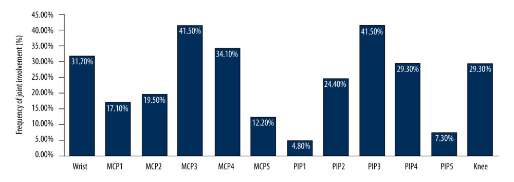 Statistical analysis of joint involvement frequency in patients with SLE undergoing evaluation by musculoskeletal ultrasound. Among the 410 MCP joints, frequency of involvement from high to low was: MCP3, MCP4, MCP2, MCP1, and MCP5. MCP – metacarpal phalangeal, PIP – proximal interphalangeal.