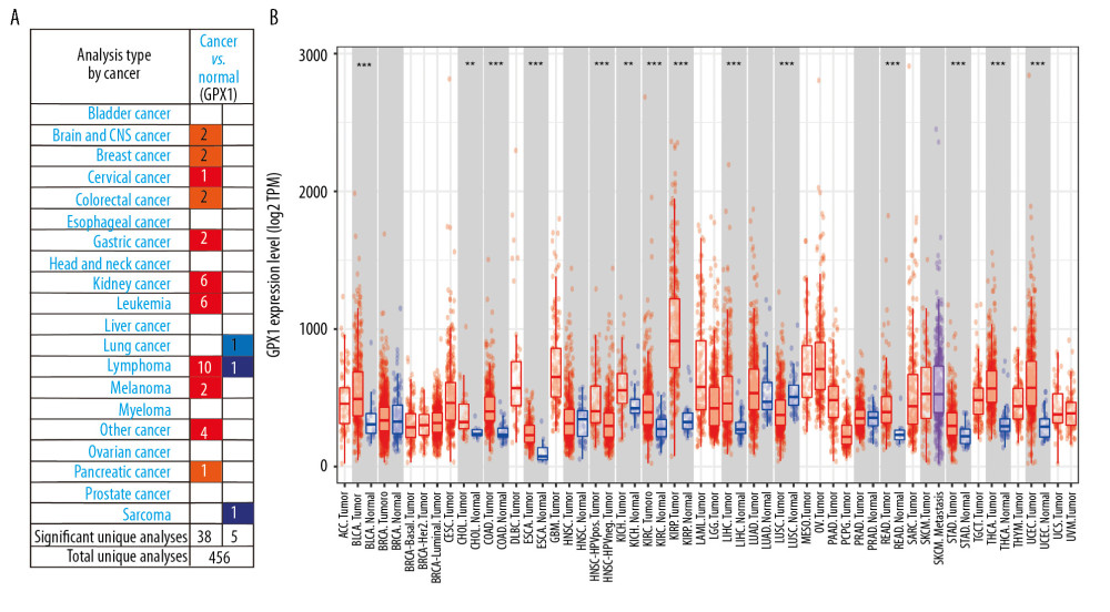 Expression of glutathione peroxidase 1 (GPX1) in multiple human tumor types. Different expression of GPX1 in the dataset of multiple tumors in ONCOMINE (A). Expression of GPX1 in 32 tumor types in Tumor Immune Estimation Resource (TIMER) dataset (B). * P<0.05, ** P<0.01, *** P<0.001.