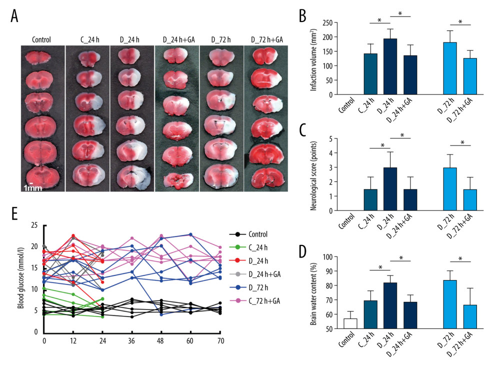 Post-treatment GA ameliorated diabetes-aggravated cerebral injury. Groups of mice were sacrificed 0 h, 12 h, 24 h, 36 h, 48 h, 60 h and 72 h after tMCAO, A. TTC staining. (B) Cerebral infarction volume. (C) Neurological scores. (D) Percentage of brain water content. (E) Blood glucose concentrations. Results are presented as mean±SD. The images are representative of 6 independent experiments. The 2 ends of each horizontal line are the 2 groups being compared. * p<0.05.