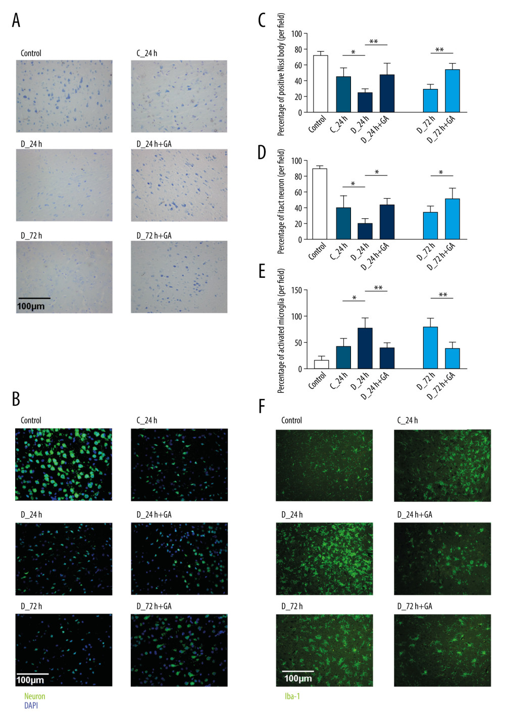 Post-treatment GA decreased neuronal loss and microglial activation. (A) Nissl staining. (B) Immunofluorescence staining of neurons. (C, D) Percentages of cells positive for Nissl staining and positive for neuronal cell markers. (E) Immunofluorescence staining of iba-1 labeled microglial. (F) Percentages of cells positive for iba-1. Data are shown as mean±SD. The images are representative of 6 independent experiments. The 2 ends of each horizontal line are the 2 groups being compared. * p<0.05, ** p<0.001.
