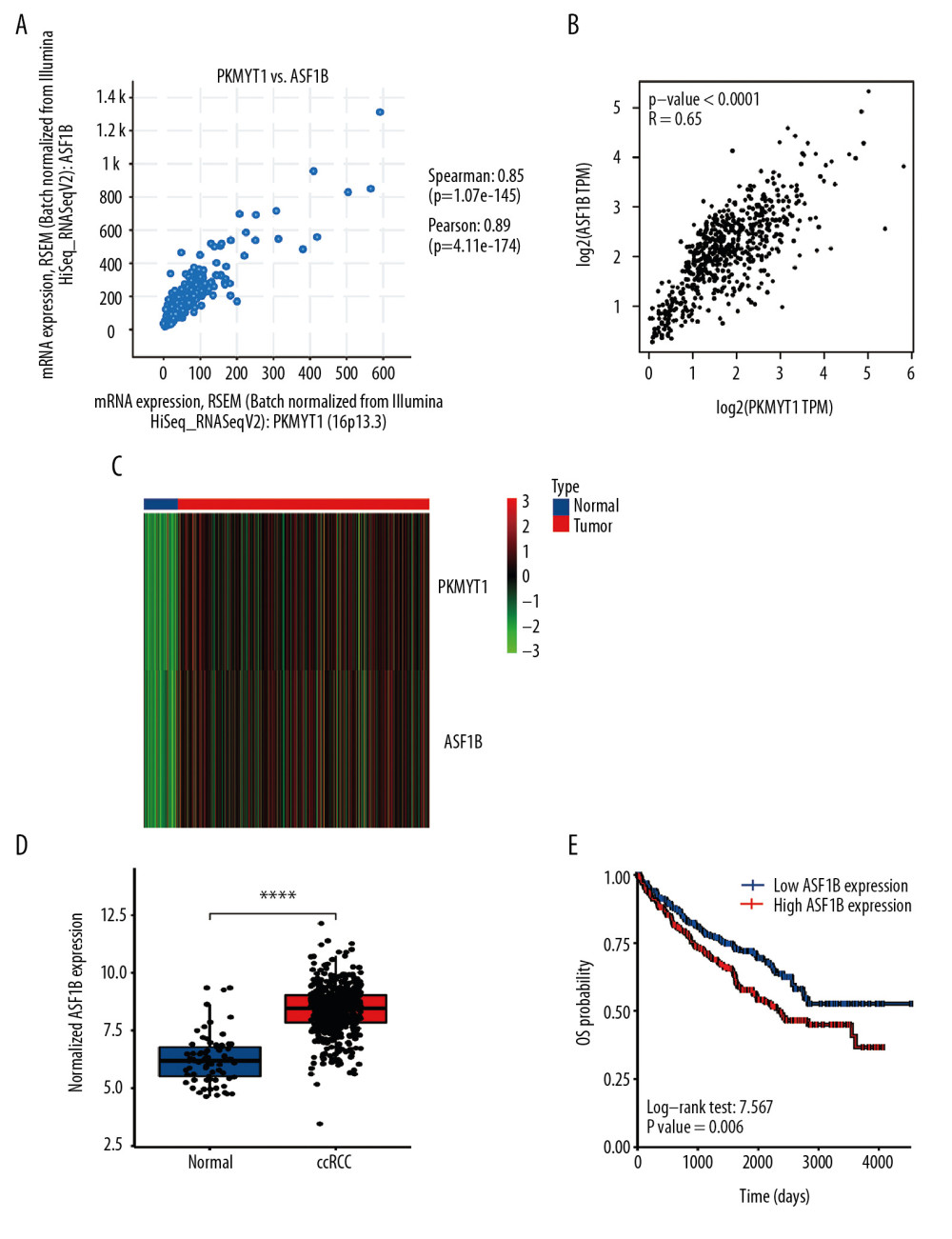 PKMYT1 is significantly correlated with ASF1B gene expression in ccRCC. There was a positive correlation between PKMYT1 and ASF1B based on (A) cBioPortal regression analysis, (B) GEPIA, and (C) TCGA dataset. (D) ASF1B was significantly increased in ccRCC compared with normal tissue. (E) High expression of ASF1B was associated with poor prognosis for ccRCC. ccRCC – clear cell renal cell carcinoma; GEPIA – Gene Expression Profiling Interactive Analysis; TCGA – The Cancer Genome Atlas.