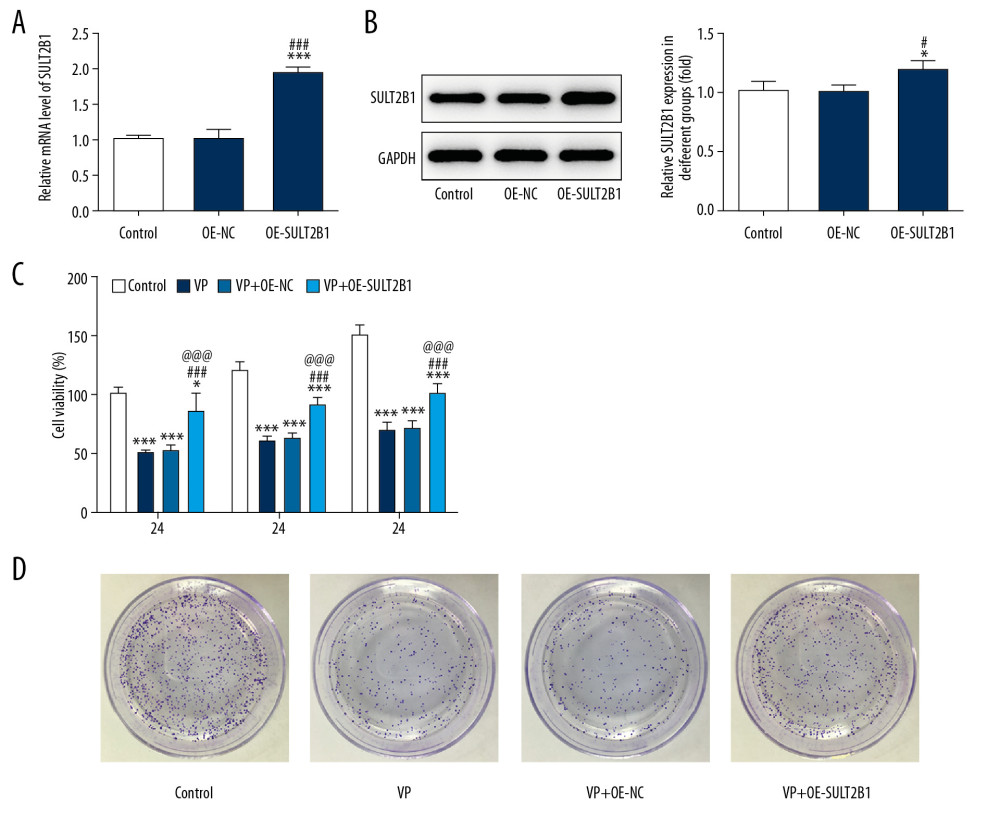 SULT2B1 overexpression weakened the inhibiting effect of verteporfin (VP) on the proliferation of cervical cancer cells. (A) The mRNA expression of SULT2B1 in HeLa cells after transfection was detected by RT-qPCR analysis. *** P<0.001 vs. Control group. ### P<0.001 vs. OE-NC group. (B) The protein expression of SULT2B1 in HeLa cells after transfection was detected by western blot analysis. * P<0.05 vs. Control group. # P<0.05 vs. OE-NC group. (C) The cell viability of HeLa cells after transfection and VP treatment was analyzed by CCK-8 assay. * P<0.05 and *** P<0.001 vs. Control group. ### P<0.001 vs. VP group. @@@ P<0.001 vs. VP+OE-NC group. (D) The clone formation ability of HeLa cells after transfection and VP treatment was determined by clone formation assay.