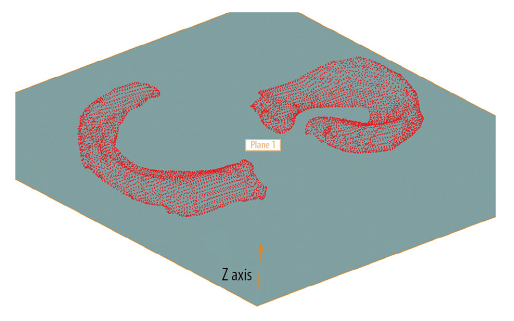 Meniscal model was converted to points cloud, and the value of Z axis of each point indicated local thickness.