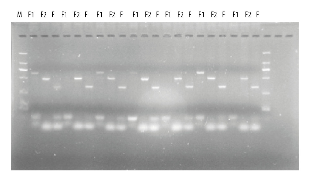 PCR identification of mouse gene gel plate results.