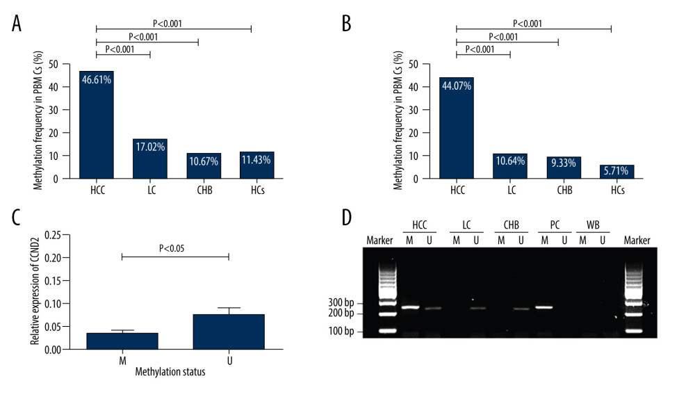 Methylation status of CCND2 promoter and correlation with expression of CCND2 mRNA. (A) In total, 55/118 (46.61%) hepatocellular carcinoma (HCC) patients, 8/47 (17.02%) liver cirrhosis (LC) patients, 8/75 (10.67%) chronic hepatitis B (CHB) patients, and 4/35 (11.43%) healthy controls (HCs) exhibited aberrant CCND2 promoter methylation in PBMCs. (B) 52/118 (44.07%) HCC patients, 5/47 (10.64%) LC patients, 7/75 (9.33%) CHB patients, and 2/35 (5.71%) HCs exhibited aberrant CCND2 promoter methylation in plasma. (C) CCND2 mRNA levels differed significantly between the methylation group and non-methylation groups (P<0.05). (D) Representative measurements of CCND2 promoter by methylation-specific polymerase chain reaction (MSP). PC – positive control; WB – water blank; M – methylated sequence; U – unmethylated sequence.