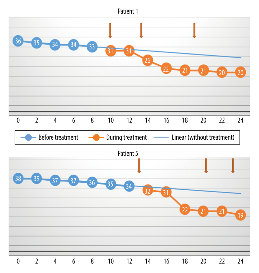The monthly change in the total Revised Amyotrophic Lateral Sclerosis Functional Rating Scale scores before and during treatment, and the linear trend function for the treatment period based on data from the pretreatment observation period. The rate of progression increased. (Arrows indicate injections.)