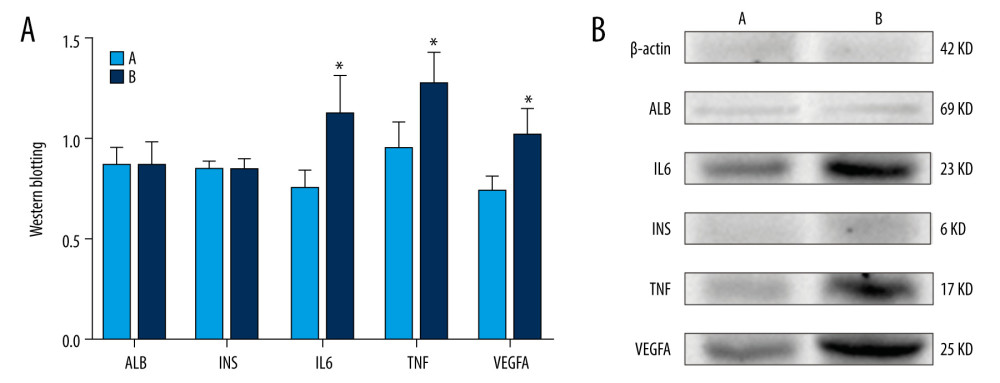 Expression of insulin (INS), albumin (ALB), tumor necrosis factor (TNF), interleukin 6 (IL6), and vascular endothelial growth factor A (VEGFA) in rat penis. (A) The red bar chart represents expression of INS, ALB, TNF, IL6, and VEGFA in group A; the blue bar chart represents expression of these substances in group B. Values are mean±SEM (n=6 animals per group). The t test was used. Group B was compared with group A, * P<0.05. (B) Western blotting showing expression of INS, ALB, TNF, IL6, and VEGFA proteins. β-Actin is a loading control.