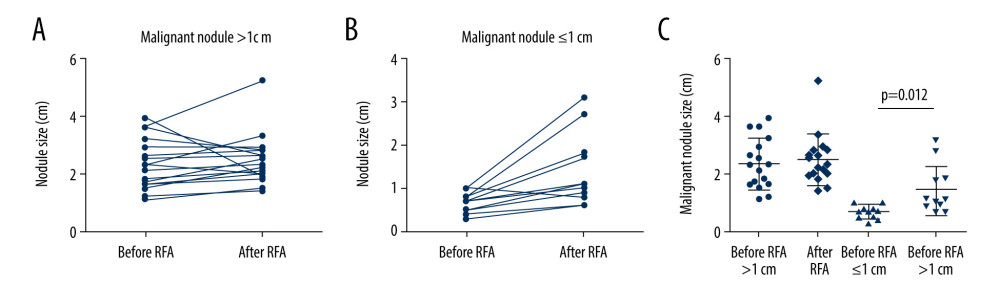 Changes in nodal size before and after radiofrequency ablation (RFA) on ultrasound. (A) The change tendency of size >1 cm malignant nodules before and after RFA. (B) The change tendency of size ≤1 cm malignant nodules before and after RFA. (C) Scatter plot of sizes of malignant nodules >1 cm or ≤1 cm.