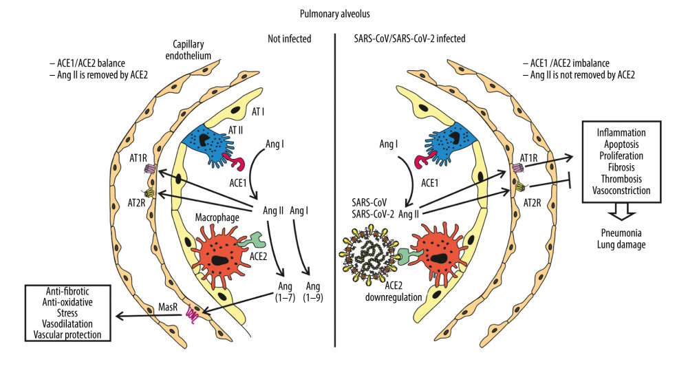 Schematic diagram of alveolus during normal homeostasis (left panel) characterized by a balanced ACE1/ACE2 pathway, and under SARS-CoV-2 infection condition (right panel) where ACE2 receptor is downregulated by SARS-CoV-2 and increasing ACE1/ACE2 unbalance causes the renin-angiotensin system (RAS) hyper-activation leading to lung injury. AT I, AT II – alveolar type I, II epithelial cell (type I, II pneumocyte); ACE1, ACE2 – angiotensin-converting enzyme 1, 2; MasR – Mas receptor; Ang I, II – angiotensin I, II; AT1R, AT2R – angiotensin II type 1, 2 receptor.