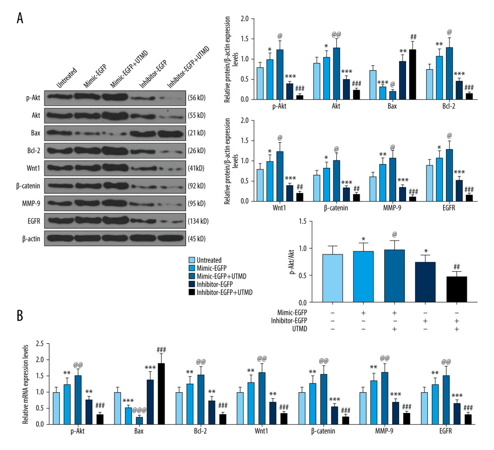 Effects of UTMD-mediated miR-21 transfection on apoptosis, metastasis, and Wnt/Akt pathway-related genes. (A) Western blot was used to detect the effects of the miR-21 plasmid on phosphorylated (p)-Akt, Akt, Bax, Bcl-2, Wnt, β-catenin, MMP-9, and EGFR expression in HeLa cells; β-actin was an internal reference (ultrasonic intensity of 1.5 W/cm2). (B) RT-qPCR was used to detect the effects of miR-21 plasmid on Akt, Bax, Bcl-2, Wnt, β-catenin, MMP-9, and EGFR expression in HeLa cells; β-actin was an internal reference (ultrasonic intensity of 1.5 W/cm2). * P<0.05, ** P<0.01, and *** P<0.001 vs untreated; @ P<0.05, @@ P<0.01 and @@@ P<0.001 vs mimic+EGFP; ## P<0.01 and ### P<0.001 vs inhibitor+EGFP. UTMD – ultrasound-targeted microbubble destruction; RT-qPCR – reverse transcription quantitative polymerase chain reaction; EGFR – epidermal growth factor receptor; EGFP – enhanced green fluorescent protein.