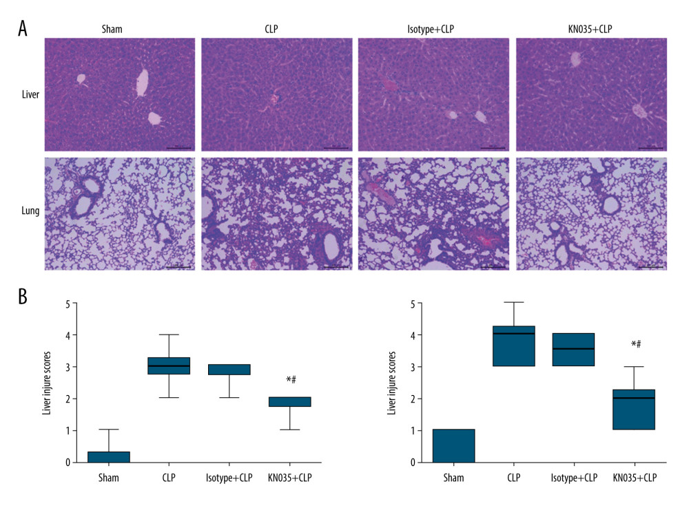 (A, B) KN035 alleviated the sepsis-induced organ injury in the lungs and livers of cecal ligation and puncture (CLP) mice. Data shown as median, minimum, and maximum values (n=6 per group). * P<0.05 vs. CLP group and isotype group, # P<0.05 vs. sham group. CLP – cecal ligation and puncture.