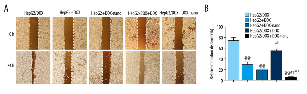 (A, B) Analysis of HepG2 or HepG2/DOX cells migration. Pictures of the scratches were photographed at 0 and 24 h. Compared with the HepG2/DOX group, @ P<0.05, @@ P<0.01; compared with the HepG2+DOX-nano group, # P<0.05, ## P<0.01; compared with the HepG2/DOX+DOX group, * P<0.05, ** P<0.01. DOX – doxorubicin; DOX-nano – doxorubicin-loaded docosahexaenoic acid nanoparticles.