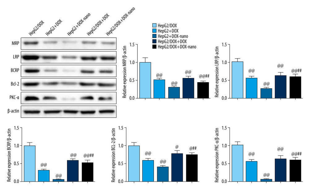 Protein expressions of drug efflux transporters, MRP, LRP, BCRP, Bcl-2, and PKC-α in HepG2 or HepG2/DOX cells. The protein expression was detected using western blotting, and β-actin was used as the internal control. Compared with the HepG2/DOX group, @ P<0.05, @@ P<0.01; compared with the HepG2+DOX-nano group, # P<0.05, ## P<0.01; compared with the HepG2/DOX+DOX group, * P<0.05, ** P<0.01. BCRP – breast cancer resistance protein; Bcl-2 – B-cell lymphoma 2; DOX – doxorubicin; DOX-nano – doxorubicin-loaded docosahexaenoic acid nanoparticles; LRP – lung resistance protein; MRP – multidrug resistance protein; PKC-α – protein kinase C alpha.