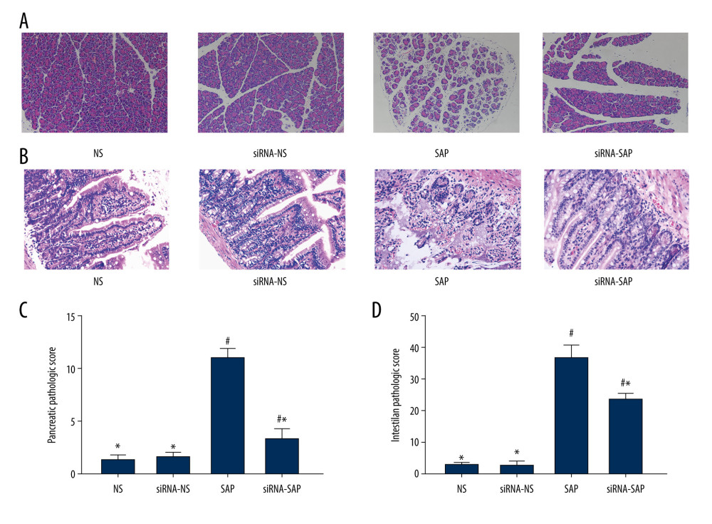 Pathological changes of pancreas and intestine in mice and quantitative analysis. (A) Pathological changes of pancreas in mice (HE×200). (B) Pathological changes of intestine in mice (HE×200). (C) Quantitative analysis of pancreatic pathological score. (D) Quantitative analysis of intestinal pathological score. * P<0.05 vs SAP group; # P<0.05 vs NS group