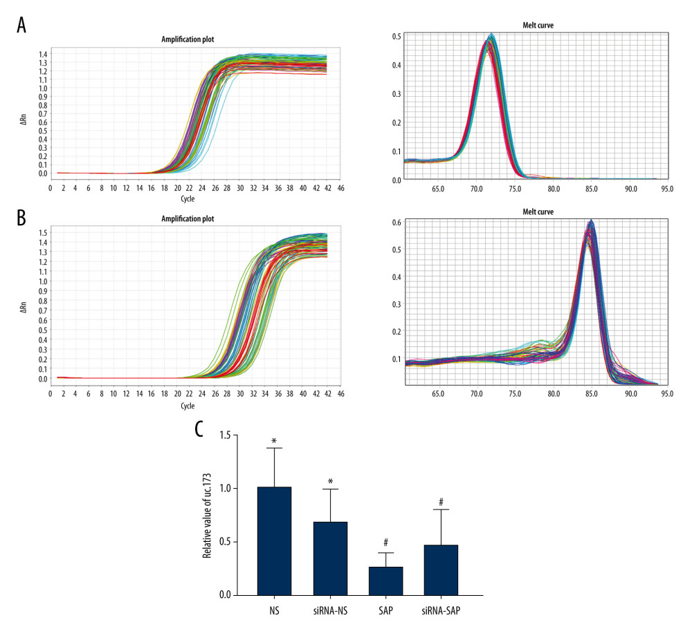 Analysis of fluorescence quantitative results of long non-coding uc.173. (A) Real-time amplification curve and product dissolution curve of long non-coding RNA UC.173. (B) Real-time amplification curve and product dissolution curve of actin. (C) Relative quantitative analysis of uc.173. * P<0.05 vs SAP group; # P<0.05 vs NS group