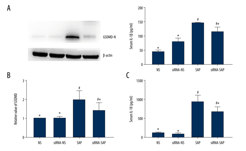 The expression of GSDMD-N and serum levels of IL-1β and IL-18. (A) The expression of GSDMD-N in the intestine. (B) Quantitative analysis of serum IL-1β. (C) Quantitative analysis of serum IL-1. * P<0.05 vs SAP group; # P<0.05 vs NS group.