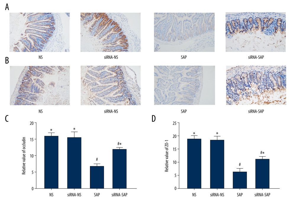 Immunohistochemical staining to detect occludin protein and ZO-1 and quantitative scoring in intestinal tissue of mice. (A) Immunohistochemical staining was performed on ileum sections to detect occludin. Original magnification (×200). (B) Immunohistochemical staining was performed on ileum sections to detect ZO-1 (×200). (C) Quantitative analysis of occludin. (D) Quantitative analysis of ZO-1. * P<0.05 vs SAP group; # P<0.05 vs NS group.