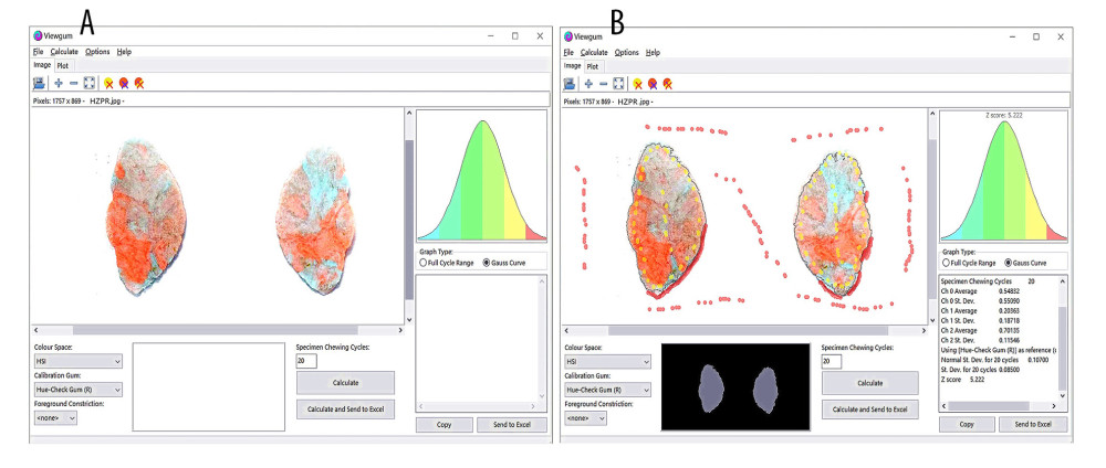 (A) The images of bicolor mixture bolus were imported into the ViewGum software. (B) The results of the image color analysis for masticatory performance.