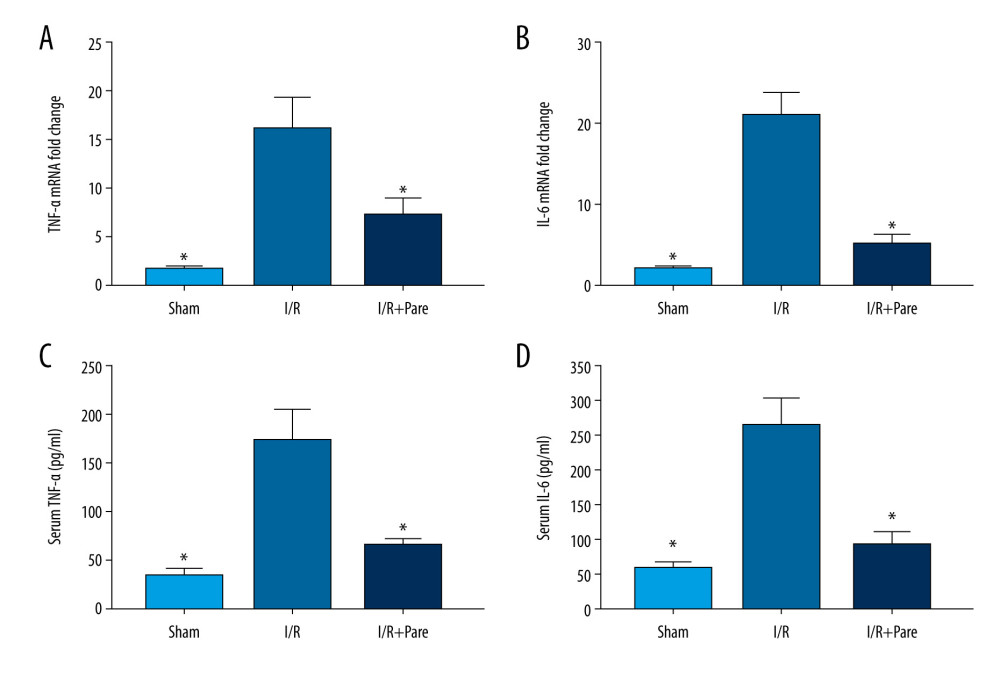 Effects of parecoxib sodium on expressions of myocardial I/R proinflammatory cytokines. (A, B) Differences in mRNA expressions of TNF-α and IL-6 in myocardial tissues. The relative mRNA expressions of TNF-α and IL-6 were markedly lower in the Sham group and I/R+Pare group than those in the I/R group (P<0.05). (C, D) Expressions of serum TNF-α and IL-6 in each group. The expressions of serum TNF-α and IL-6 were lower in the Sham group and I/R+Pare group than those in the I/R group (P<0.05). (* P<0.05 vs. I/R group).