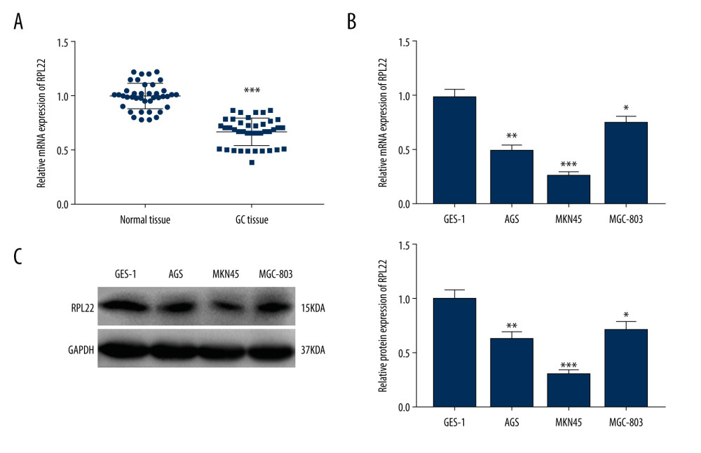 Ribosomal protein L22 (RPL22) is downregulated in gastric cancer tissues and cell lines. (A) The mRNA expression of RPL22 in gastric cancer tissues and normal tissues was detected by a quantitative real-time-polymerase chain reaction. (B) The mRNA expression of RPL22 in gastric cancer cell lines (AGS, MKN-45, and MGC-803) and the normal human gastric epithelial cell line (GES-1) was detected by a quantitative real-time-polymerase chain reaction. (C) The protein expression of RPL22 in gastric cancer cell lines and the normal human gastric epithelial cell line (GES-1) was detected by a western blot. (A) *** P<0.001 vs normal tissues; (B, C) * P<0.05, ** P<0.01, *** P<0.001 vs GES-1.