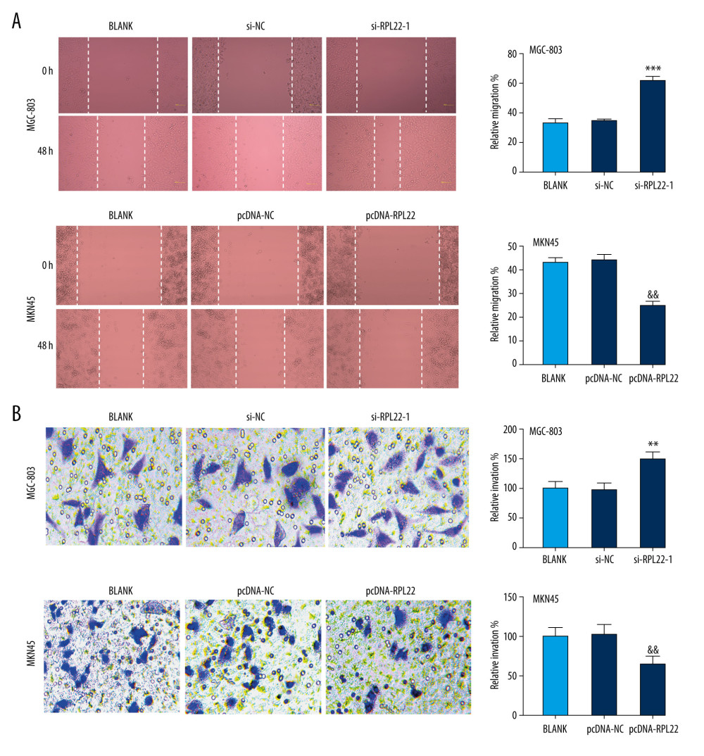 Ribosomal protein L22 (RPL22) influences the migration and invasion of gastric cancer cells.(A) The relative migration of MKN-45 and MGC-803 cells was detected by a wound healing assay. (B) The relative invasion of MKN-45 and MGC-803 cells was detected by a transwell assay. BLANK – cells without transfection; pcDNA-NC – cells transfected with pcDNA negative control; pcDNA-RPL22 – cells transfected with pcDNA-RPL22; si-NC – cells transfected with siRNA negative control; si-RPL22-1 – cells transfected with siRNA-RPL22-1. (A, B) ** P<0.01, *** P<0.001 vs BLANK; && P<0.01 vs BLANK.