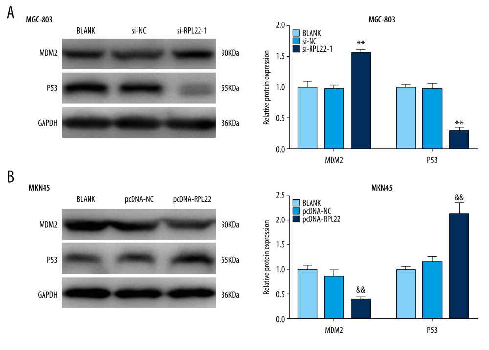 Silencing the ribosomal protein L22 (RPL22) activates MDM2-p53 signaling. (A) The expression of MDM2-p53 signaling-related proteins (MDM2 and p53) in MGC-803 cells was detected by a western blot. (B) The expression of MDM2-p53 signaling-related proteins (MDM2 and p53) in MKN45 cells was detected by a western blot. BLANK – cells without transfection; pcDNA-NC – cells transfected with pcDNA negative control; pcDNA-RPL22 – cells transfected with pcDNA-RPL22 plasmid; si-NC – cells transfected with siRNA negative control; si-RPL22-1 – cells transfected with siRNA-RPL22-1. (A, B) ** P<0.01 vs BLANK; ## P<0.01 vs BLANK.