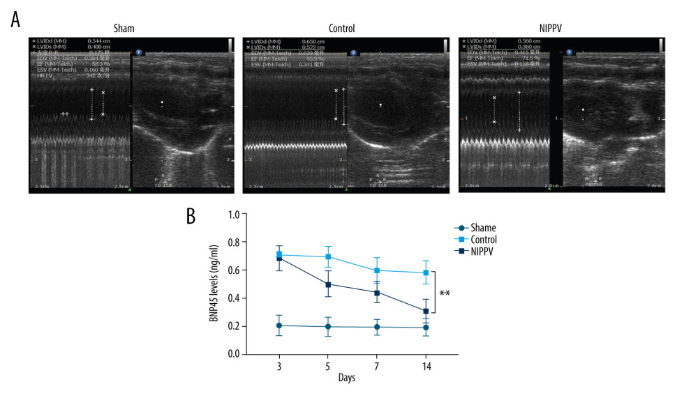 Rat model of heart failure induced by acute myocardial infarction was confirmed by ultrasonic cardiography (UCG) and brain natriuretic peptide (BNP)45 detection. (A) UCG of 3 rats in each group. (B) Levels of BNP45 detected in the sham group, control group, and noninvasive positive-pressure ventilation group. ** P<0.01.