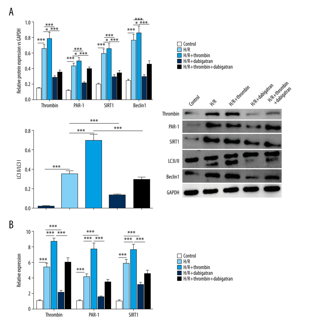 Induction of autophagy by thrombin in H/R-injured cardiomyocytes. (A) Western blotting was applied to determine the level of thrombin, PAR-1, SIRT1, Beclin1, and the conversion of LC3I to LC3II. (B) qRT-PCR was conducted to detect the expression of thrombin, PAR-1, and SIRT1. *** P<0.001 vs control group, n=3.