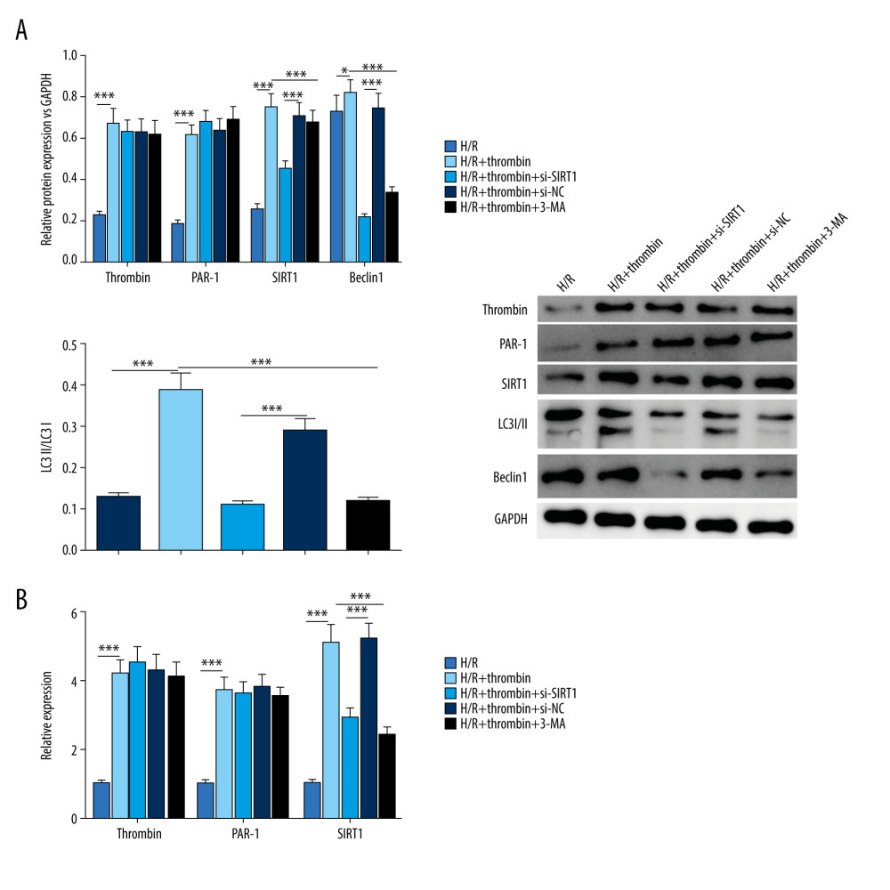 Silencing of SIRT1 suppressed the regulation by thrombin of autophagy in H/R-injured astrocytes. (A) Western blotting was applied to determine the level of thrombin, PAR-1, SIRT1, Beclin1, and the conversion of LC3I to LC3II. (B) qRT-PCR was conducted to detect the expression of thrombin, PAR-1, and SIRT1. *** P<0.001 vs control group, n=3.