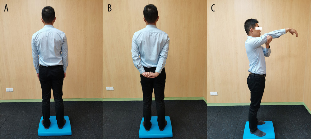 Upper-limb conditions in 3 groups: (A) Control group, (B) Back group, (C) Shoulder elevation group. The affected upper limb is on the right side.