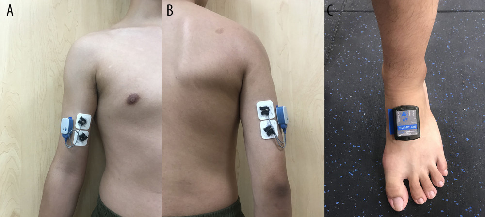 Placement of EMG sensors (A, B: in the arm) and accelerometers (C: in the dorsal of foot).