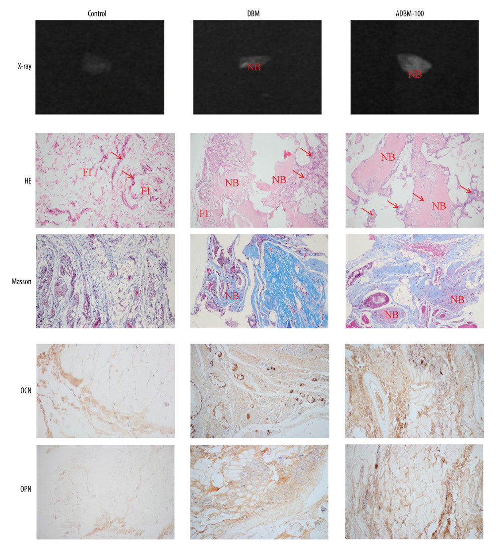 Representative images of X-ray, hematoxylin and eosin staining, Masson’s trichrome staining, and immunohistochemistry of ectopically formed bone tissue. “NB” represents the newly formed bone. “FI” represents the fibrous tissue. The red arrow refers to the inflammatory cells.